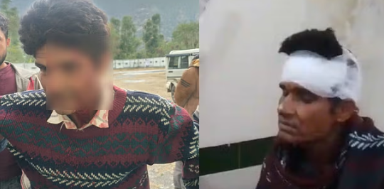 नैनीताल: खेतों में बकरी चराते समय तेंदुए ने ग्रामीण पर किया हमला, हिम्मत दिखाकर ऐसे बचाई जान