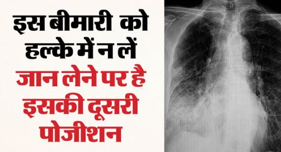 खतरा बढ़ता ही जा रहा: दिल्ली में हार्ट अटैक के बाद इस बीमार से मर रहे सबसे अधिक लोग, बच्चे होते हैं ज्यादा शिकार