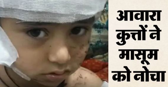 स्कूल के पहले दिन 4 साल के मासूम को कुत्तों नोचा,सिर की चमड़ी नोची, चीख भी नहीं सुन पाया स्टाफ