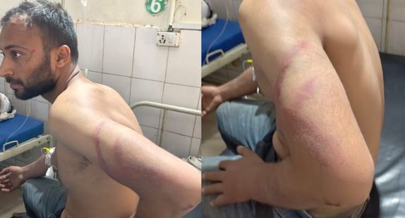 इंस्टाग्राम पर मोहब्बत: शादीशुदा महिला ने बुलाया घर, परिजनों ने किया ऐसा तमाशा, जीवनभर नहीं करेगा प्यार करने की भूल