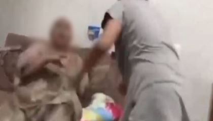 सास का कूल्हा और तोड़ा हाथ, फिर भी न रुकी बेरहम बहू, बर्बरता देख इलाज करने वाले डॉक्टर भी चौंके