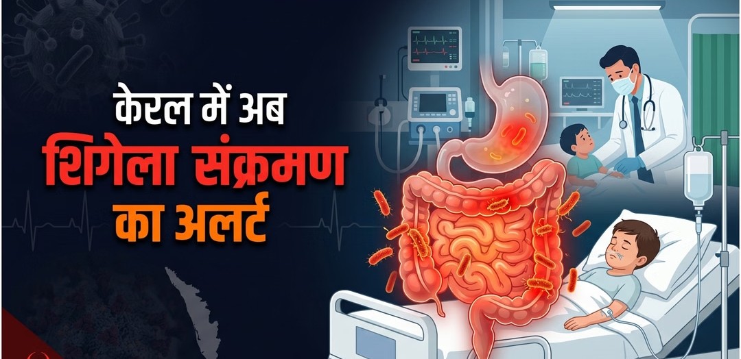Shigella: केरल में शिगेला का कहर, 126 लोग संक्रमित और मासूम की मौत से दहशत, जानिए…