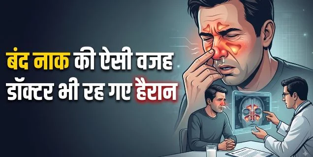 साइनस: बंद नाक ने सांस लेना कर दिया था मुश्किल, दवाएं भी हो रही थीं बेअसर, फिर आई सामने हैरान करने वाली वजह